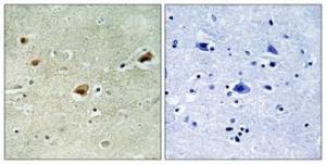 Immunohistochemical analysis of paraffin-embedded human brain using Anti-ARNT2 Antibody 1:100 (4°C overnight). The right hand panel represents a negative control, where the antibody was pre-incubated with the immunising peptide.