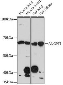 Western blot analysis of extracts of various cell lines, using Anti-Angiopoietin 1 Antibody [ARC0248] (A305757) at 1:1000 dilution