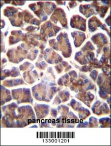 Anti-GNAS Rabbit Polyclonal Antibody