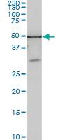 Anti-ZSCAN21 Mouse Monoclonal Antibody [clone: 4B3]