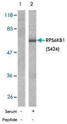 Anti-RPS6KB1 Rabbit Polyclonal Antibody