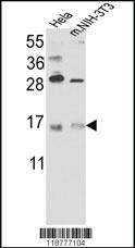 Anti-ACVR1 Rabbit Polyclonal Antibody