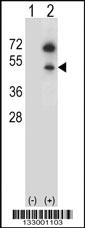 Anti-GNAS Rabbit Polyclonal Antibody