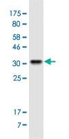 Anti-TNFRSF19 Mouse Monoclonal Antibody [clone: 2G4]