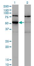 Anti-ZSCAN21 Mouse Monoclonal Antibody [clone: 4B3]