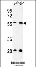 Anti-SKA3 Rabbit Polyclonal Antibody