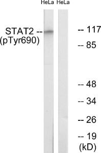 Western blot analysis of lysates from HeLa cells treated with IFN 2500U/ml 30' using Anti-STAT2 (phospho Tyr690) Antibody. The right hand lane represents a negative control, where the antibody is blocked by the immunising peptide.