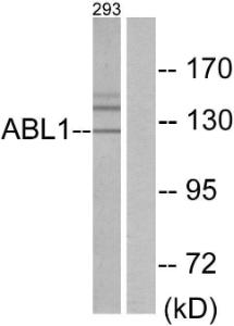 Western blot analysis of lysates from 293 cells using Anti-ABL1 Antibody. The right hand lane represents a negative control, where the antibody is blocked by the immunising peptide.