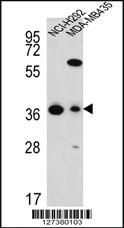 Anti-PITPNB Rabbit Polyclonal Antibody