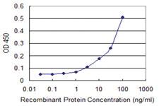 Anti-ZSCAN21 Mouse Monoclonal Antibody [clone: 4B3]