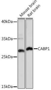 Western blot analysis of extracts of various cell lines, using Anti-CABP Antibody (A307350) at 1:1000 dilution