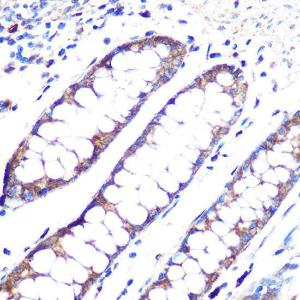 Immunohistochemistry analysis of paraffin-embedded human colon tissue using Anti-Angiopoietin 1 Antibody [ARC0248] (A305757) at a dilution of 1:100 (40x lens)