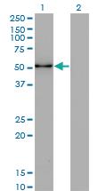 Anti-ZSCAN21 Mouse Monoclonal Antibody [clone: 4F10]