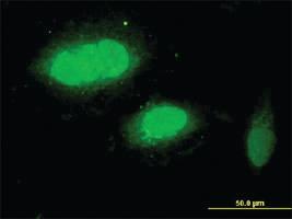 Anti-WRAP53 Mouse Monoclonal Antibody [clone: 1F12]