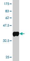 Anti-SMARCA5 Mouse Monoclonal Antibody [clone: 3F4]