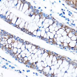 Immunohistochemistry analysis of paraffin-embedded human colon tissue using Anti-CABP Antibody (A307350) at a dilution of 1:50 (40x lens). Perform microwave antigen retrieval with 10 mM PBS buffer pH 7.2 before commencing with IHC staining protocol