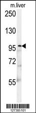 Anti-KIF9 Rabbit Polyclonal Antibody