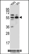 Anti-NAE1 Rabbit Polyclonal Antibody