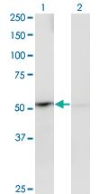 Anti-PPOX Mouse Monoclonal Antibody [clone: 2C10]