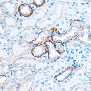 Immunohistochemistry analysis of paraffin-embedded mouse kidney using Anti-CABP Antibody (A307350) at a dilution of 1:50 (40x lens). Perform microwave antigen retrieval with 10 mM PBS buffer pH 7.2 before commencing with IHC staining protocol