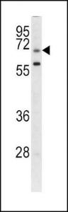 Anti-GARP Rabbit polyclonal antibody