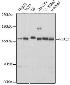 Western blot analysis of extracts of various cell lines, using Anti-NPAS3 Antibody (A308335) at 1:1,000 dilution The secondary antibody was Goat Anti-Rabbit IgG H&L Antibody (HRP) at 1:10,000 dilution Lysates/proteins were present at 25 µg per lane