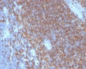 Immunohistochemical analysis of formalin-fixed, paraffin-embedded human lymph node using Anti-CD4 Antibody [CD4/7142] at 2 µg/ml in PBS for 30 minutes at room temperature