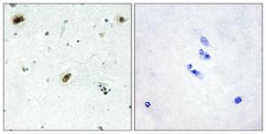 Immunohistochemical analysis of paraffin-embedded human brain tissue using Anti-ABL1 Antibody. The right hand panel represents a negative control, where the antibody was pre-incubated with the immunising peptide.