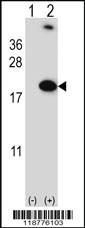 Anti-RBM3 Rabbit Polyclonal Antibody