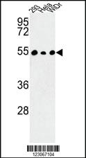 Anti-TAF9B Rabbit Polyclonal Antibody