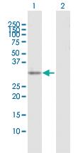 Anti-EXOSC3 Rabbit Polyclonal Antibody