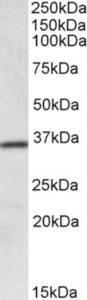 EB10043 (0.1 µg/ml) staining of Human Colon lysate (35 µg protein in RIPA buffer). Primary incubation was 1 hour. Detected by chemiluminescence.