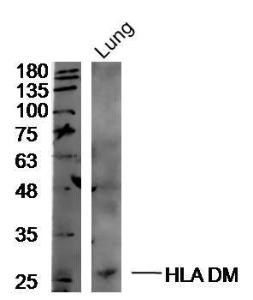 Anti-HLA-DMA Rabbit Polyclonal Antibody