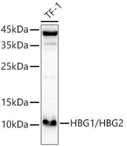 Western blot analysis of extracts of TF-1, using Anti-fetal hemoglobin Antibody (A307353) at 1:1,000 dilution. The secondary antibody was Goat Anti-Rabbit IgG H&L Antibody (HRP) at 1:10,000 dilution.