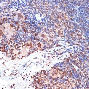 Immunohistochemistry analysis of paraffin-embedded mouse spleen using Anti-5 Lipoxygenase/5-LO Antibody [ARC1926] (A14230) at a dilution of 1:100 (40X lens). Perform microwave antigen retrieval with 10 mM Tris/EDTA buffer pH 9.0 before commencing with IHC staining protocol