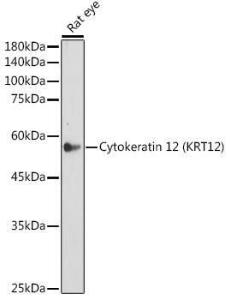 Western blot analysis of extracts of Rat eye, using Anti-Keratin 12 / K12 Antibody [ARC2465] (A305758) at 1:500 dilution. The secondary antibody was Goat Anti-Rabbit IgG H&L Antibody (HRP) at 1:10,000 dilution.