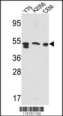 Anti-APCS Rabbit Polyclonal Antibody