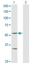 Anti-PPOX Mouse Monoclonal Antibody [clone: 2B5]