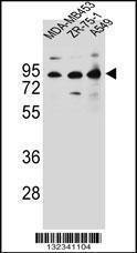 Anti-CTTNBP2NL Rabbit Polyclonal Antibody (FITC (Fluorescein Isothiocyanate))