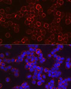 Immunofluorescence analysis of K-562 cells using Anti-fetal hemoglobin Antibody (A307353) at a dilution of 1:100 (40x lens). DAPI was used to stain the cell nuclei (blue).