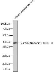 Western blot analysis of extracts of Mouse skeletal muscle, using Anti-Cardiac Troponin T Antibody [ARC1242] (A308336) at 1:10,000 dilution. The secondary antibody was Goat Anti-Rabbit IgG H&L Antibody (HRP) at 1:10,000 dilution.