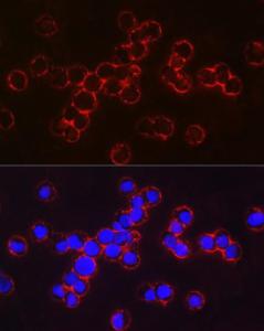 Immunofluorescence analysis of TF-1 cells using Anti-fetal hemoglobin Antibody (A307353) at a dilution of 1:100 (40x lens). DAPI was used to stain the cell nuclei (blue).