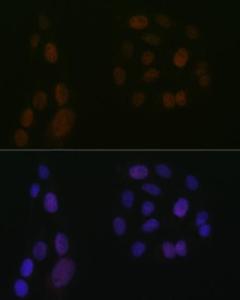 Immunofluorescence analysis of U-2 OS cells using Anti-5 Lipoxygenase/5-LO Antibody [ARC1926] (A14230) at a dilution of 1:100 (40X lens). DAPI was used to stain the cell nuclei (blue)