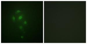 Immunofluorescence analysis of A549 cells using Anti-MSK1 (phospho Thr581) Antibody. The right hand panel represents a negative control, where the antibody was pre-incubated with the immunising peptide.