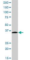 Anti-EXOSC3 Rabbit Polyclonal Antibody