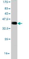 Anti-RNF123 Mouse Monoclonal Antibody [clone: 3F8]