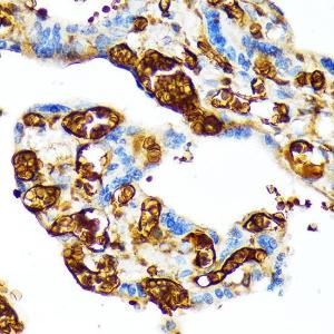 Immunohistochemistry analysis of paraffin-embedded human placenta using Anti-fetal hemoglobin Antibody [ARC1838] (A307354) at a dilution of 1:100 (40X lens). Perform microwave antigen retrieval with 10 mM Tris/EDTA buffer pH 9.0 before commencing with IHC staining protocol