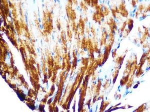 Immunohistochemistry analysis of paraffin-embedded mouse heart using Anti-Cardiac Troponin T Antibody [ARC1242] (A308336) at a dilution of 1:100 (40x lens). Perform microwave antigen retrieval with 10 mM PBS buffer pH 7.2 before commencing with IHC staining protocol.