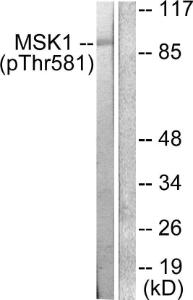 Western blot analysis of lysates from RAW264.7 cells treated with UV 5' using Anti-MSK1 (phospho Thr581) Antibody. The right hand lane represents a negative control, where the antibody is blocked by the immunising peptide.