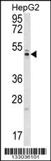 Anti-WDR12 Rabbit Polyclonal Antibody